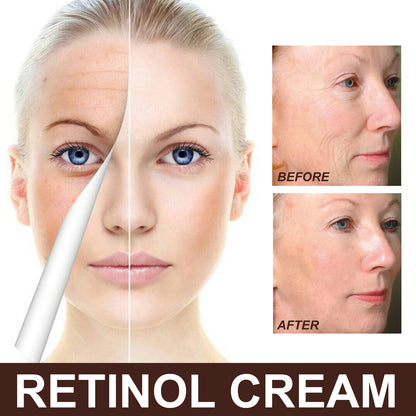 Retinol Anti-Aging Wrinkle Removal & Skin Firming Cream.