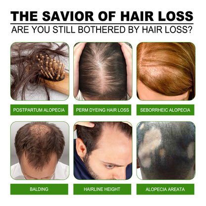 Jaysuing Hair Treatment.
