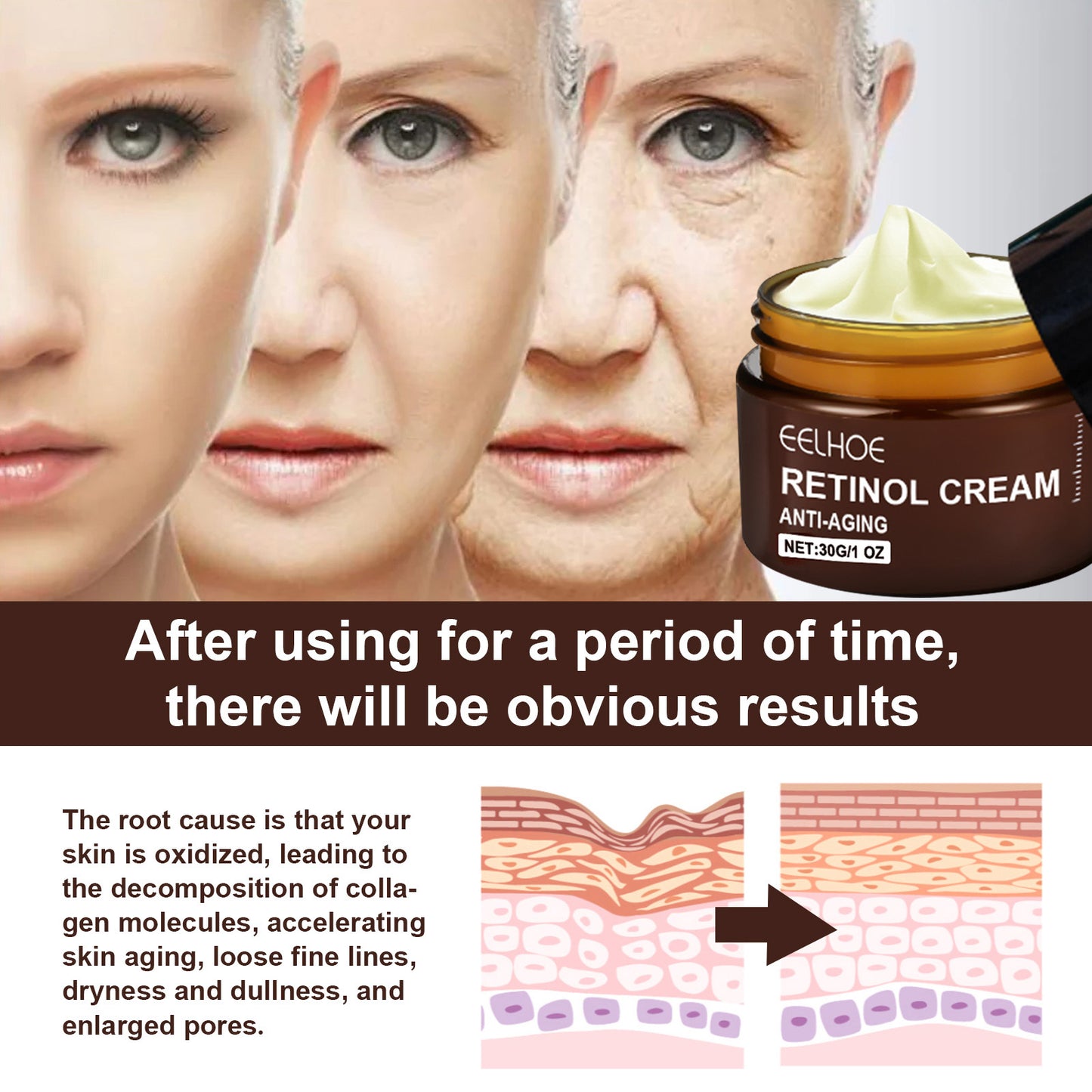 Retinol Anti-Aging Wrinkle Removal & Skin Firming Cream.